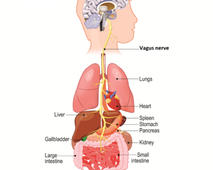 Nervus vagus stimulatie, clusterhoofdpijn en migraine
